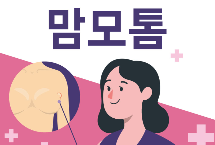 맘모톰 수술 총정리