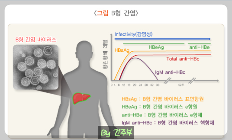B형간염(그림 출처 : 질병관리청)