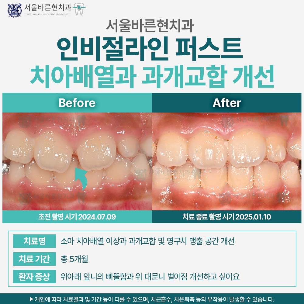 해운대인비절라인퍼스트