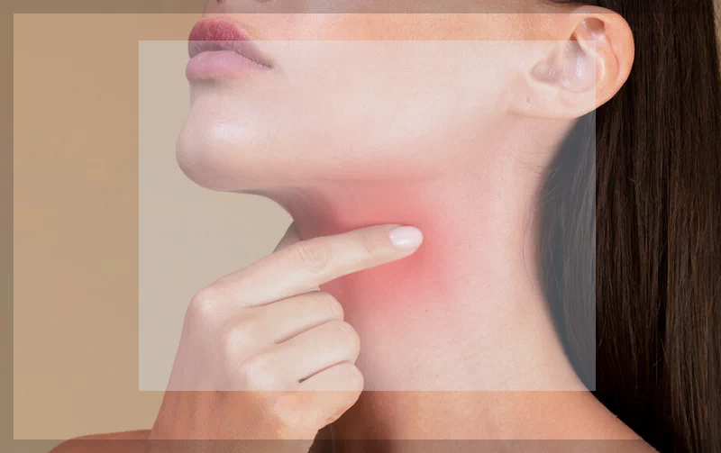 역류성 후두염_