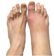 발등이 아픈 이유