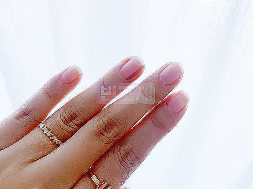 오호라 젤네일 부작용