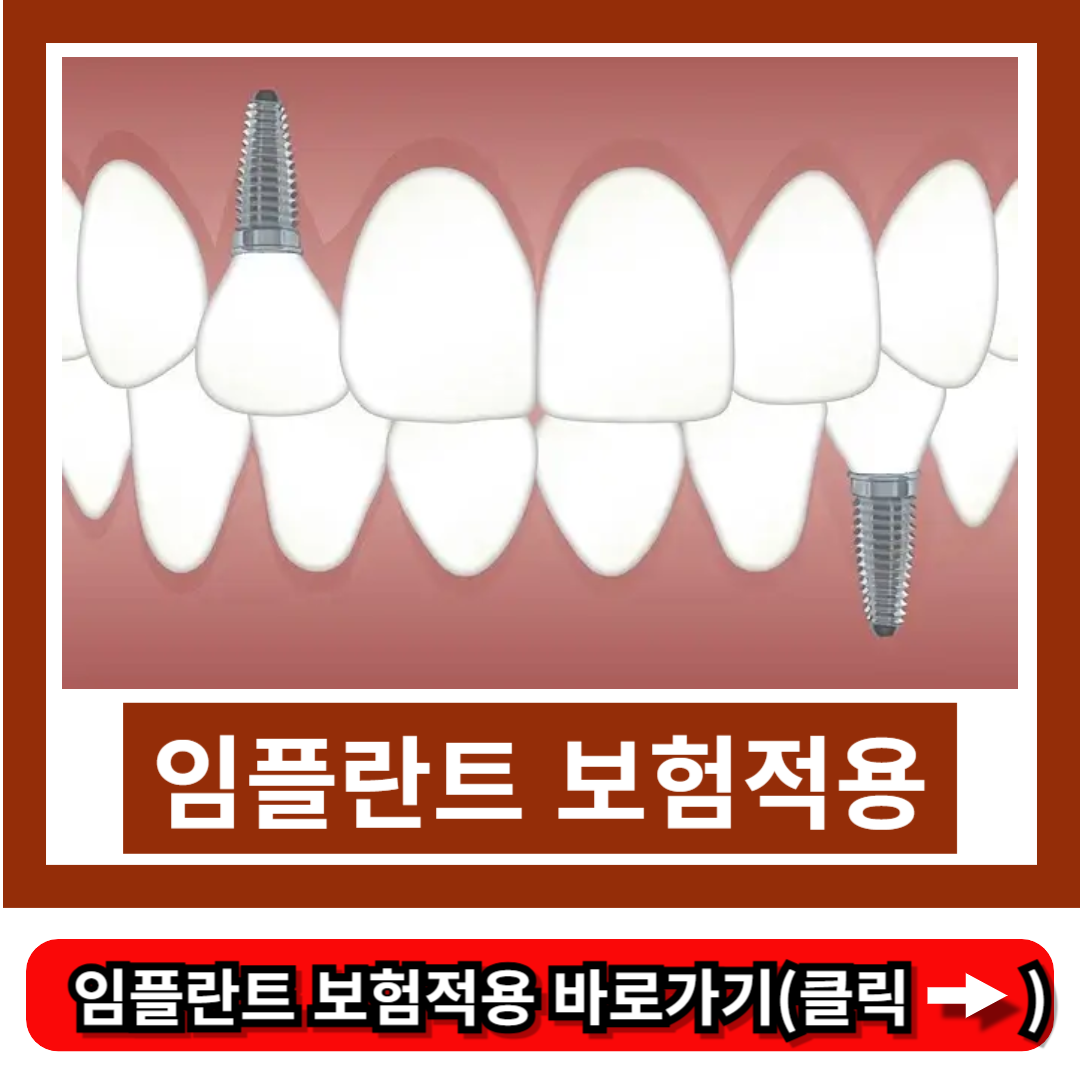 임플란트 보험적용