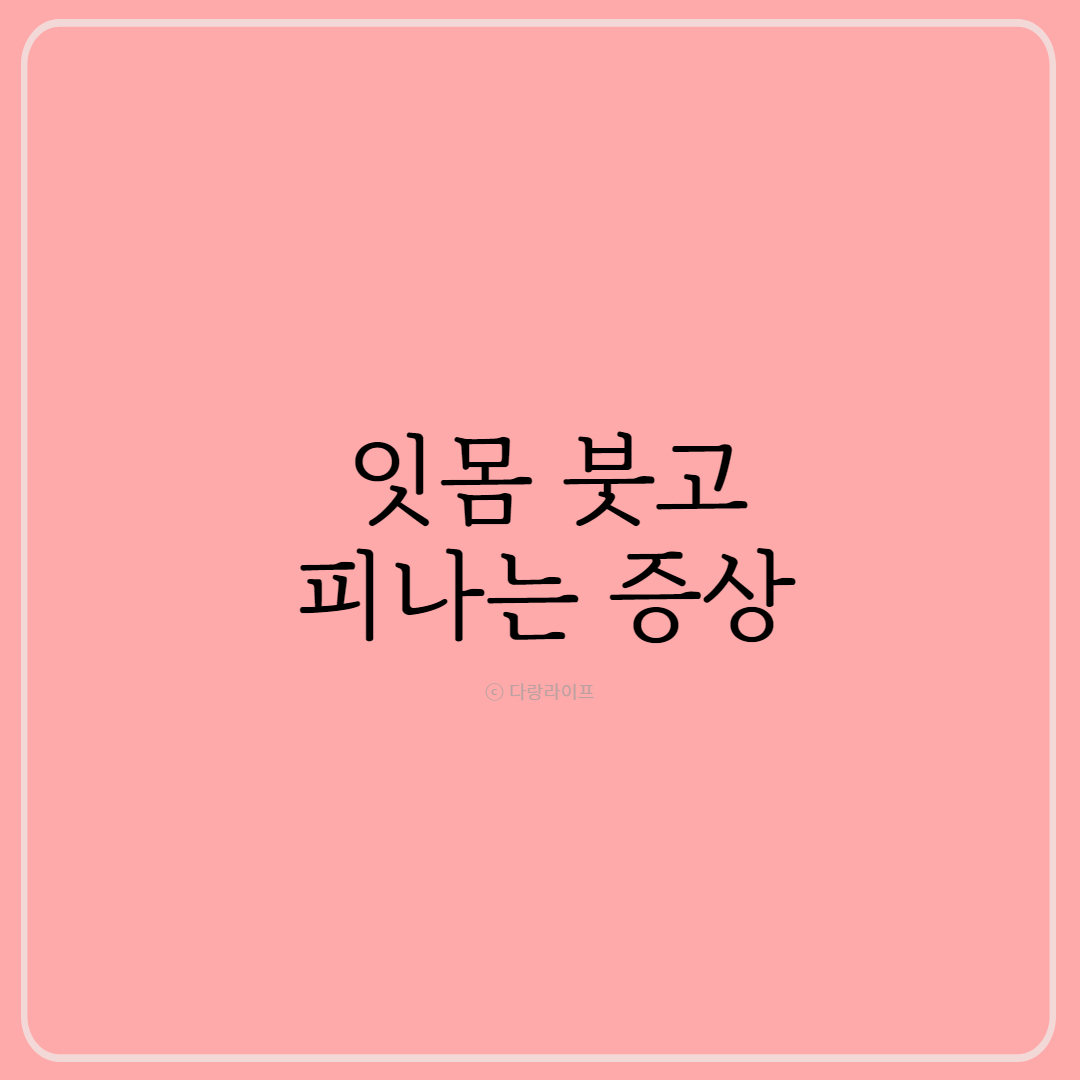 잇몸 붓고 피나요 치은염