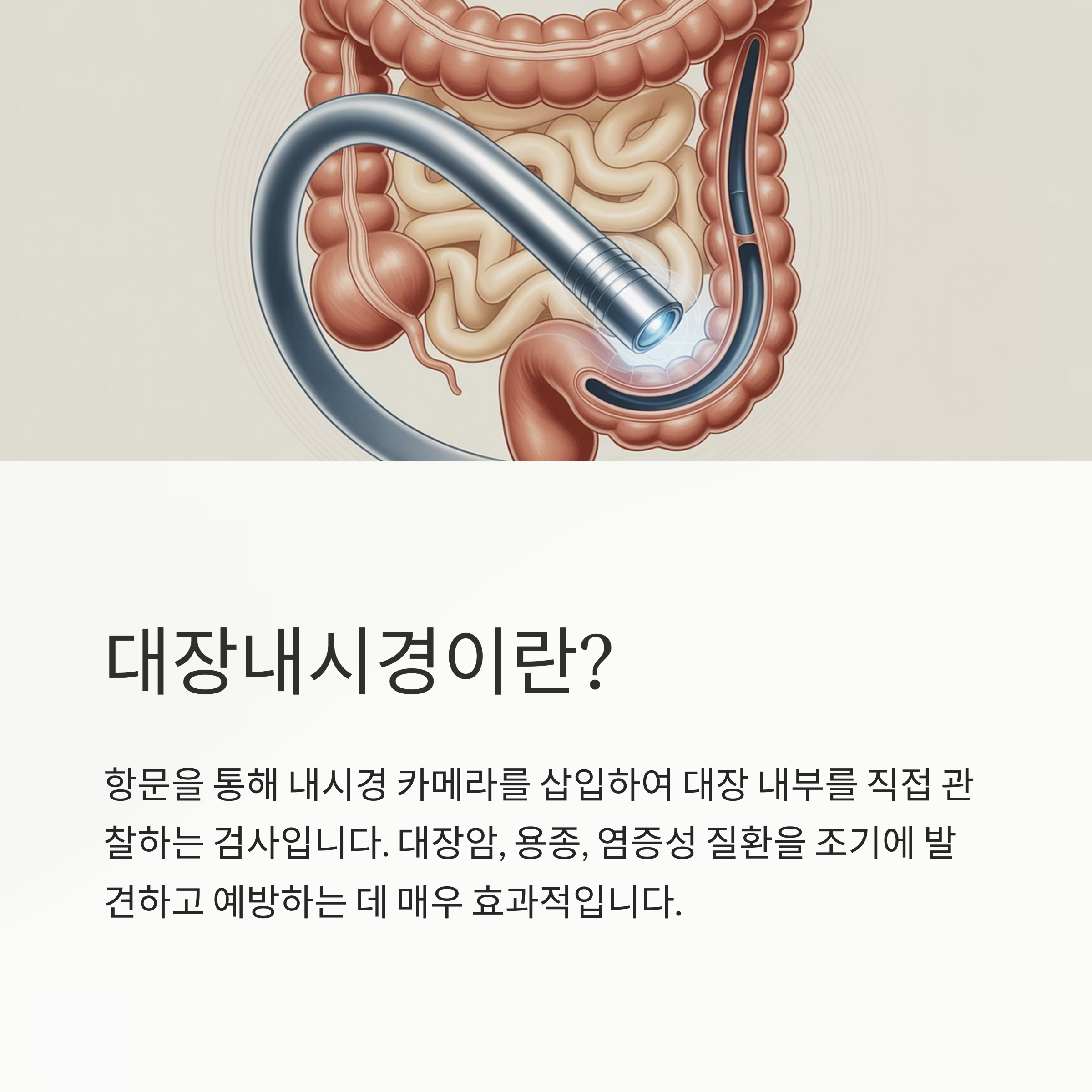 내시경