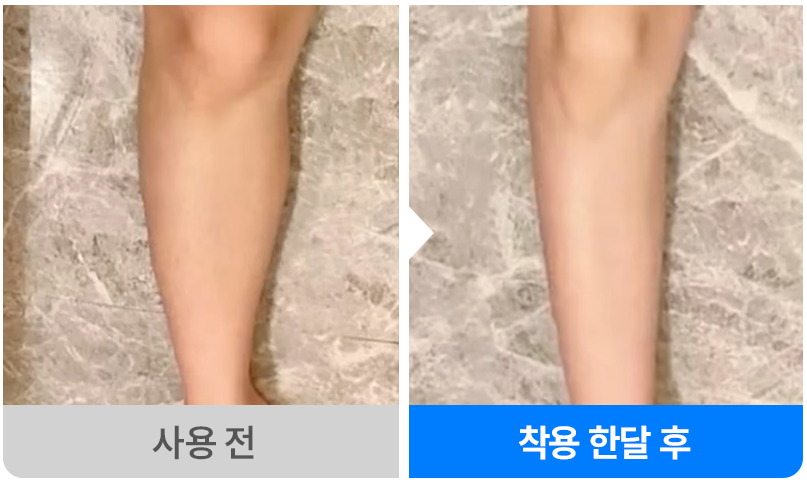 필라스밴드 종아리
