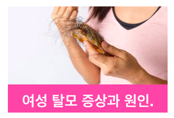 여성 탈모.