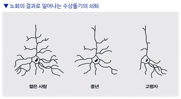 노화로 인해 수상돌기 쇠퇴 안내