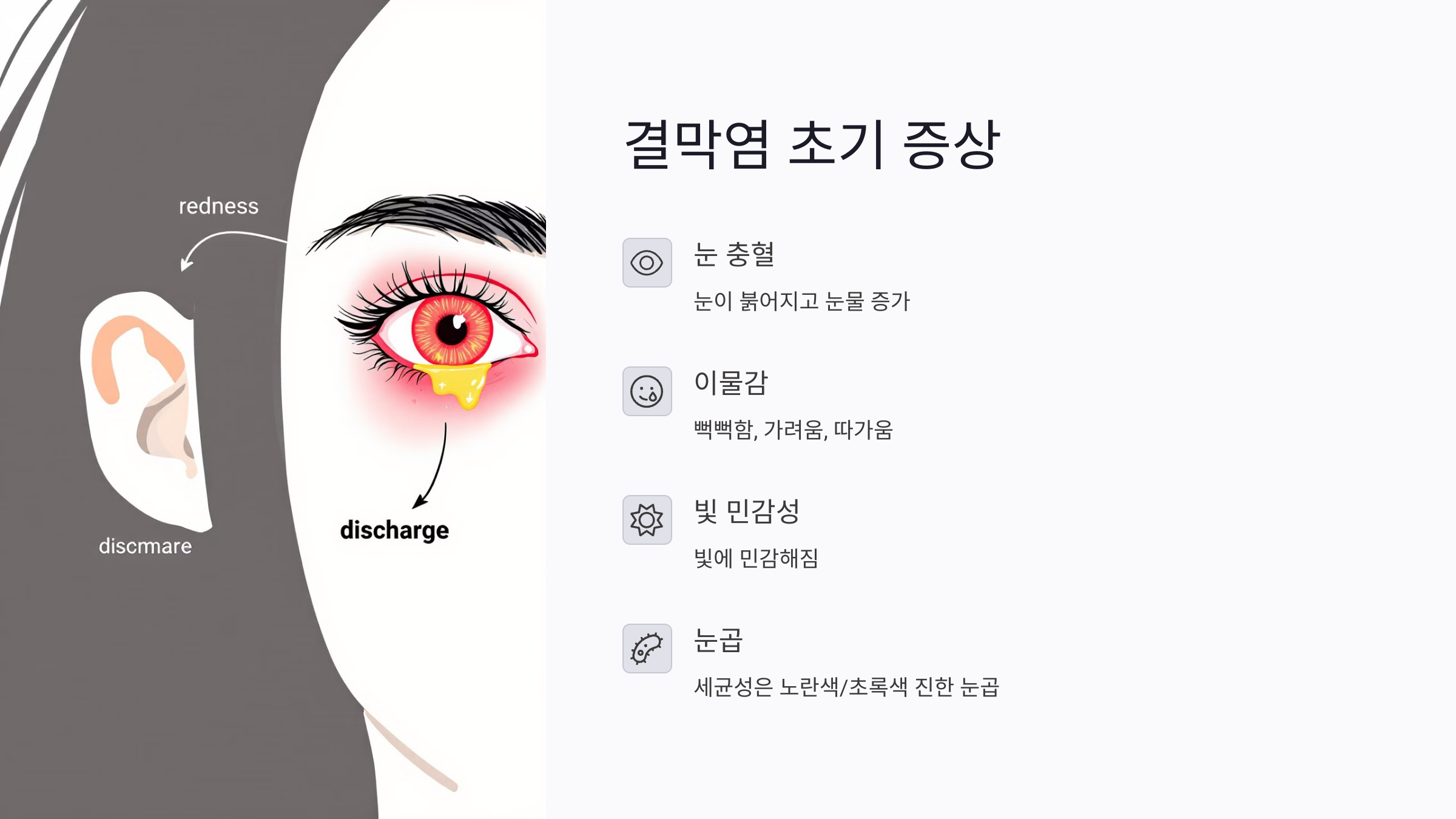 결막염 병원 방문 타이밍