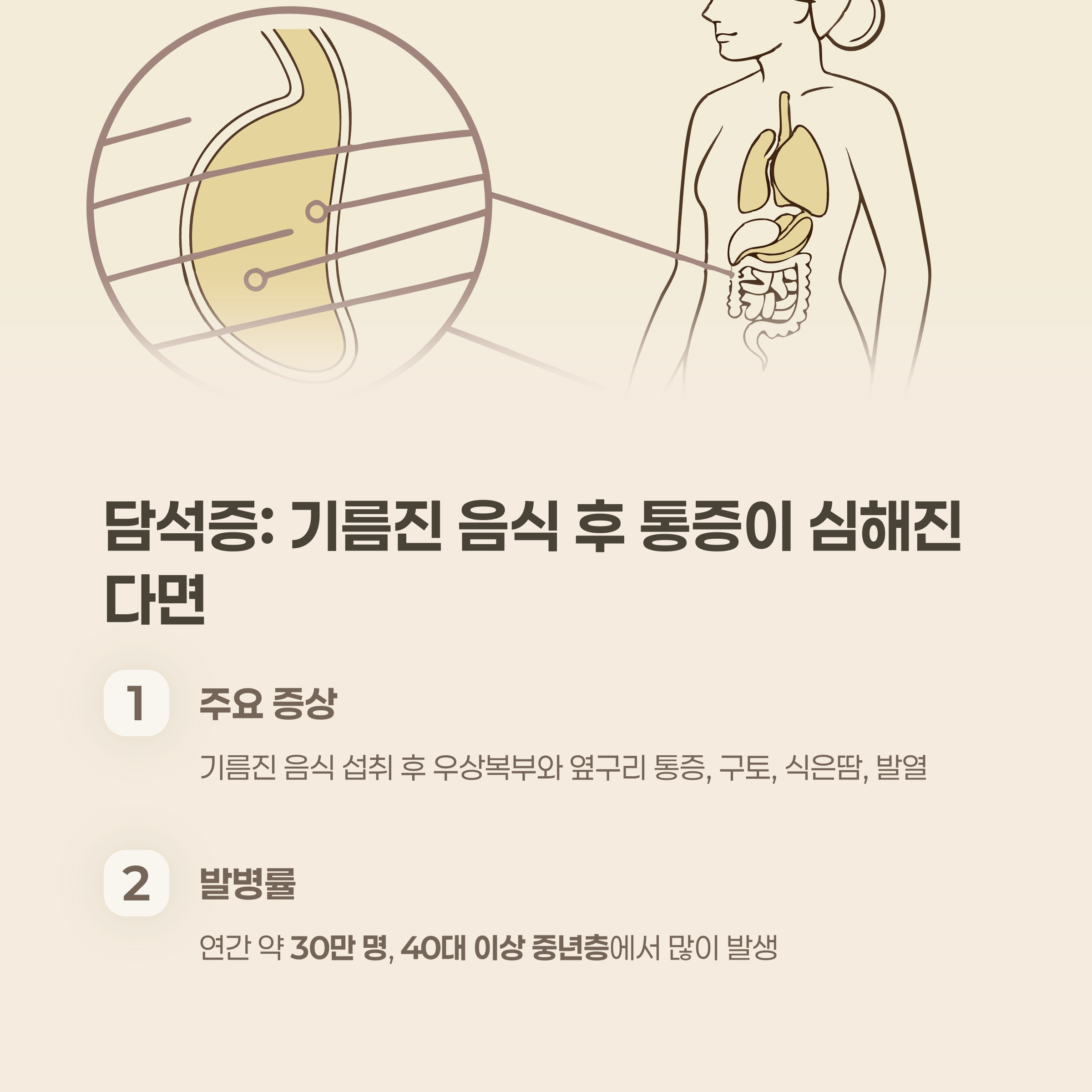 담석증: 기름진 음식 후 통증이 심해진다면