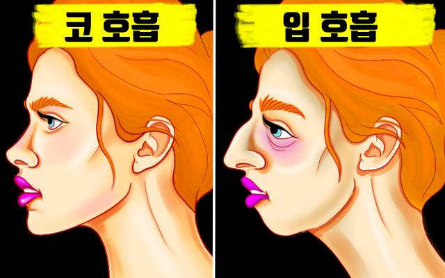 입으로 숨쉬면 얼굴변화