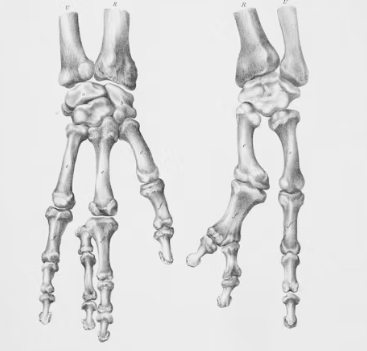 류마티스 관절염 치료법 진단 합병증