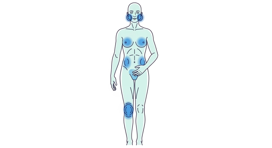 심장과 신장 기능 저하로 다리가 붓는 상황을 요약한 개념 그림