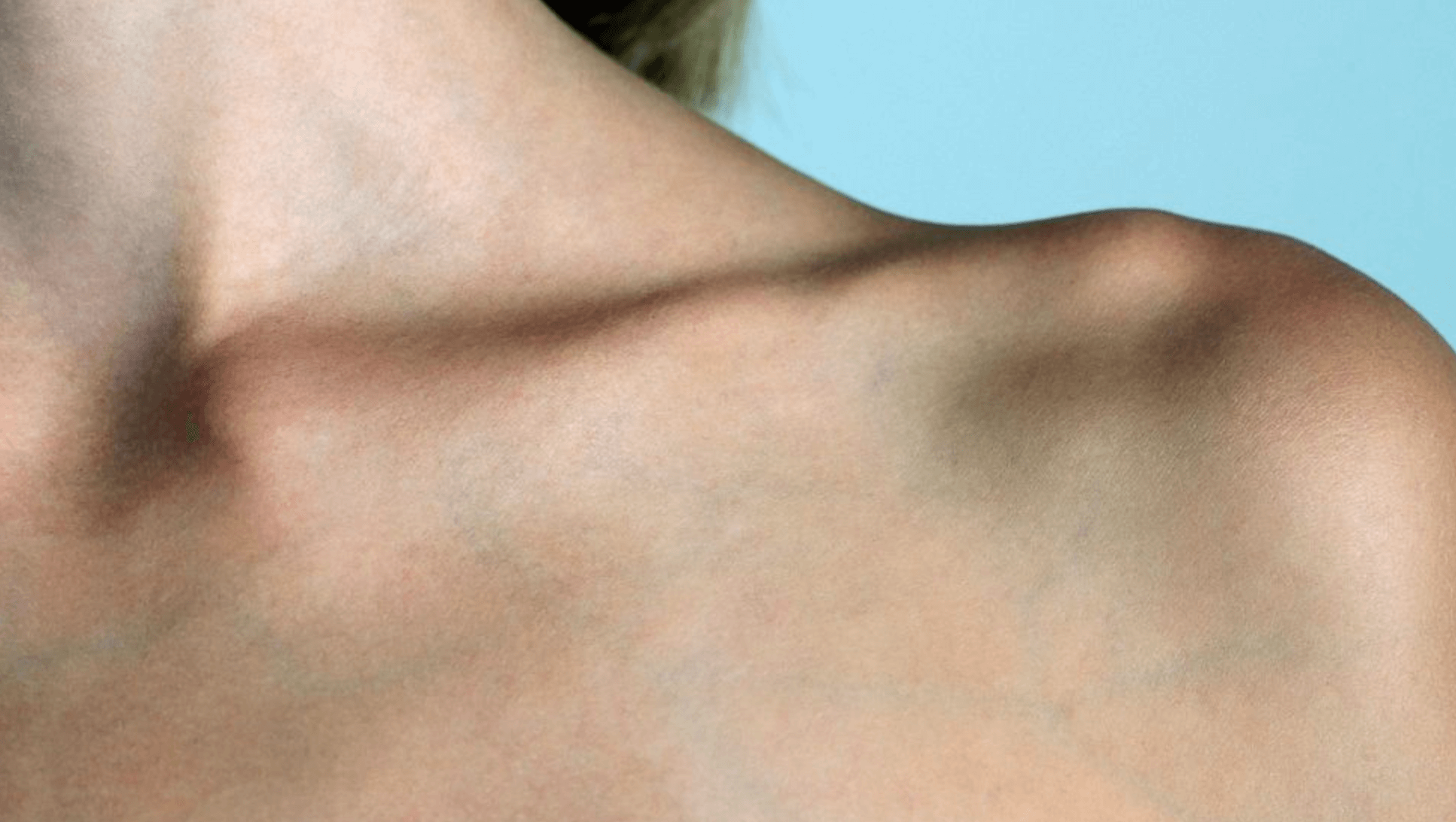 쇄골 부음 이유