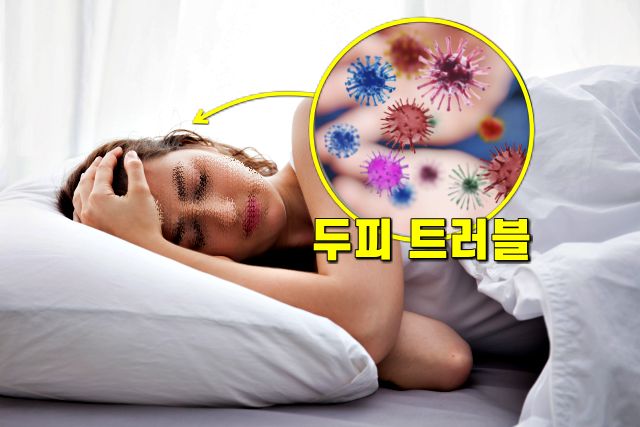 머리 안말리고 자면, 두피트러블, 건강, 팁줌