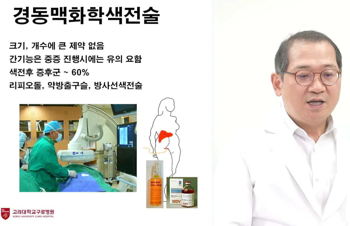 명의-지방간염-김지훈-교수-간암수술