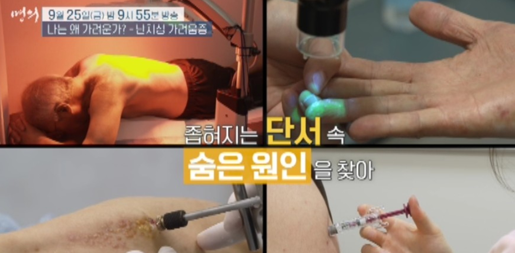 EBS-명의-난치성-가려움증-김혜원-교수