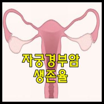 자궁경부암 생존율