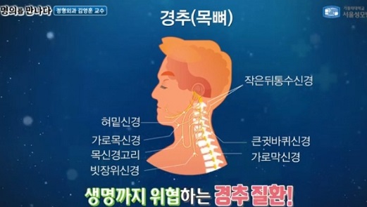 경추질환