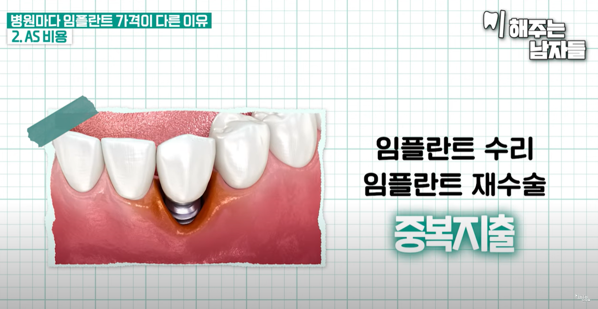 A/S 비용 내용