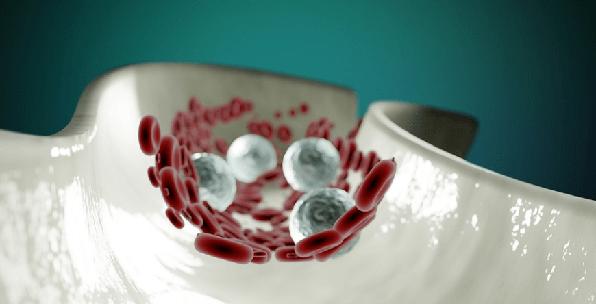 하품이 자주 나오는 이유로 심근 경색에 대한 해부학의 혈관 모습