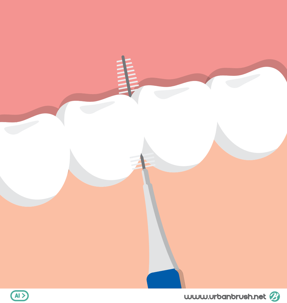 치간칫솔하는법