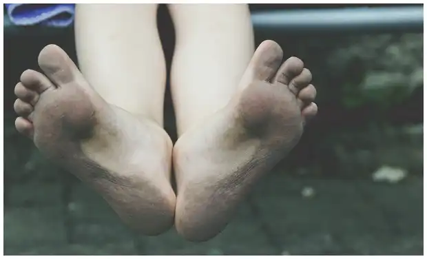 족저 근막염 치료법 (주사, 약, 걷기 중단 방법 등)