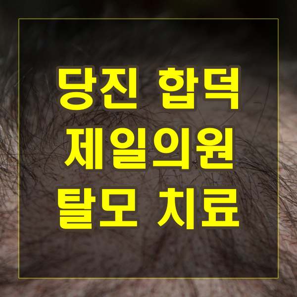 당진 합덕 제일의원 탈모 치료