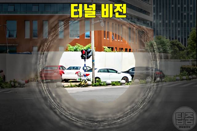 40대 50대 시야가 좁아지는 현상 녹내장