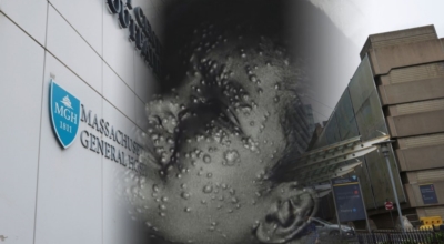 원숭이두창 이미지