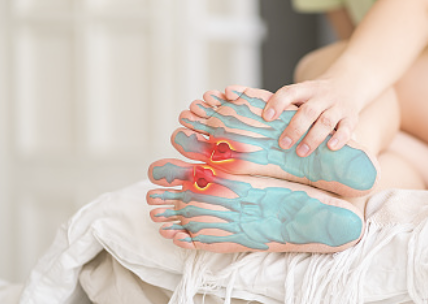 발바닥통증의 원인 21