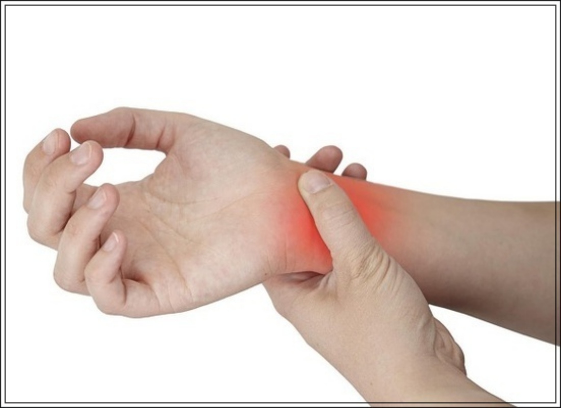 드퀘르벵병 건초염 수술 사진