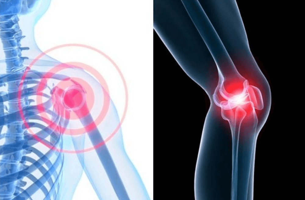 노화로-인해-어깨와-무릎에-발생한-염증