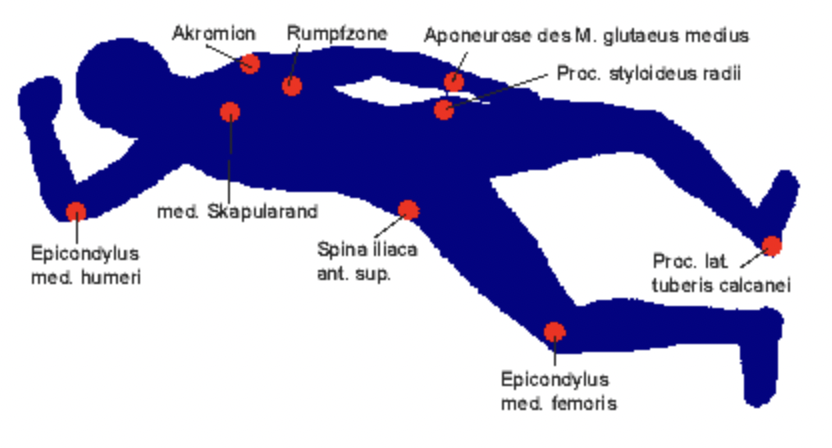 보이타 치료의 주요 자세와 자극점 이해하기