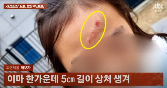 초등학생이 다치는 사고