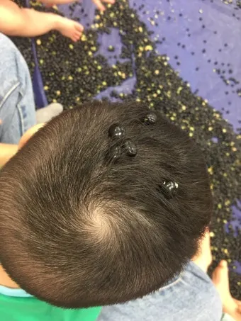 똥이 까만색 검정똥 원인과 질병 가능성_10
