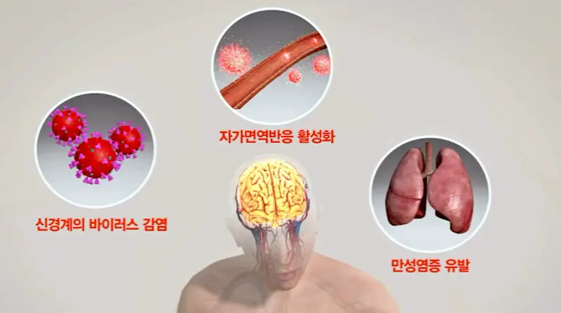 KBS 생로병사의 비밀 827회 재유행 코로나 연대기 2부 끝나지 않는 고통 코로나 후유증 롱코비드