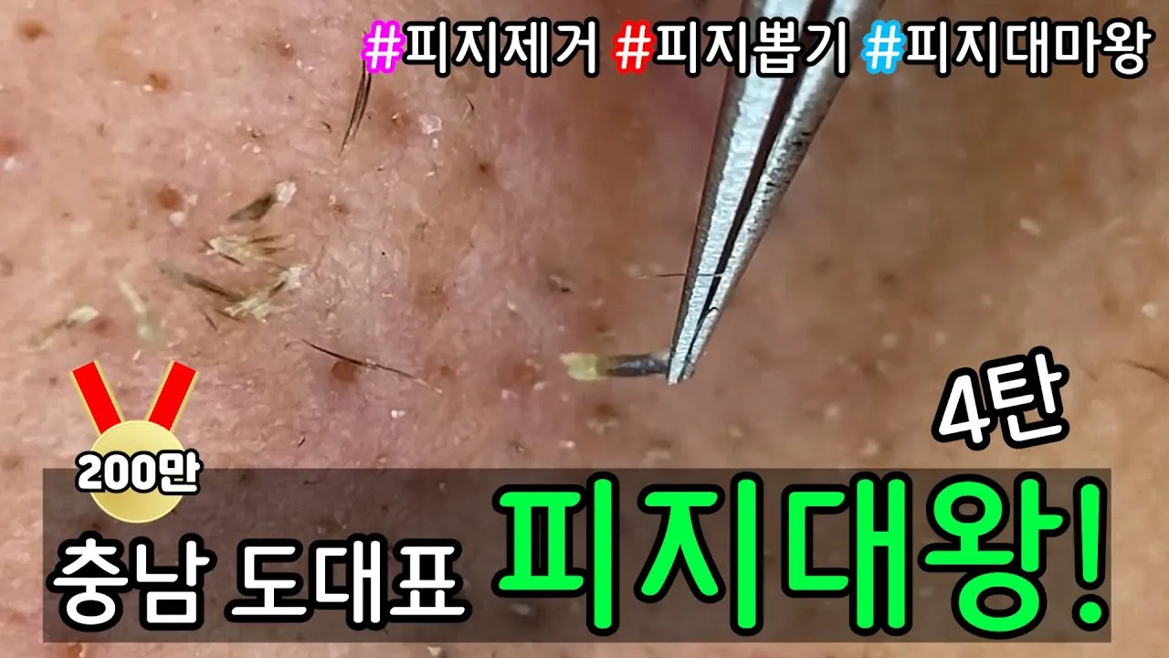 남자 얼굴 피지 제거 화장품 꿀템_3