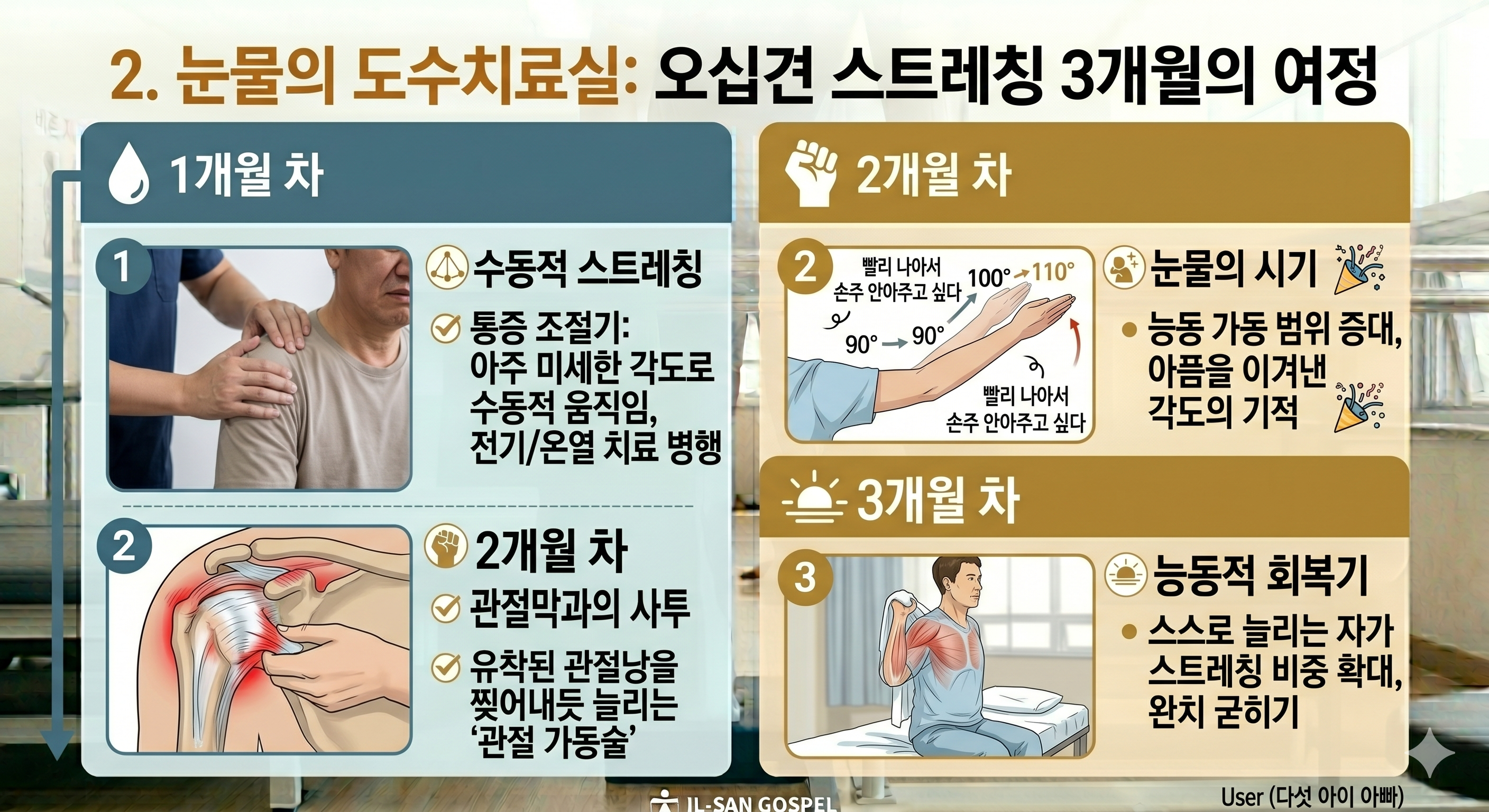 눈물의 도수치료실: 오십견 스트레칭 3개월의 여정