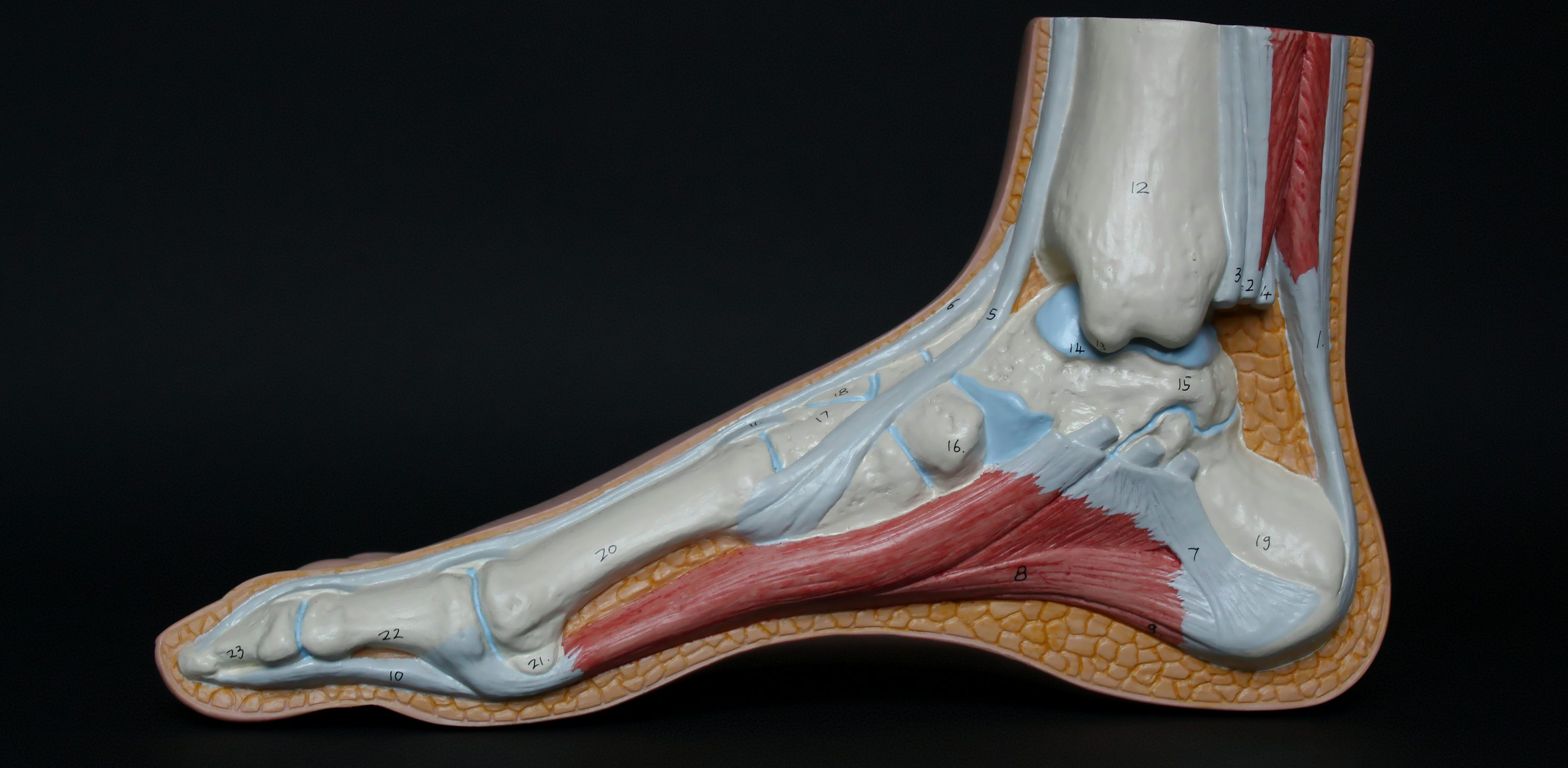 족저근막염 발바닥통증 여름신발 샌들추천 발건강스트레칭
