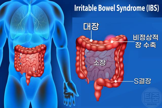방귀 너무 자주 나오면 이유 냄새 지독 방귀 자독 뀌는 사람 과민성대장증후군