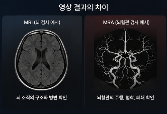 MRI와 MRA의 차이점
