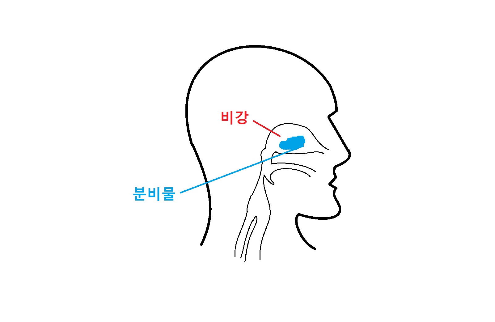 코막힘-비강-그림