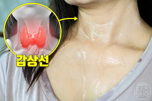 땀 많이 나는 병 다한증 원인 갑상선기능항진증