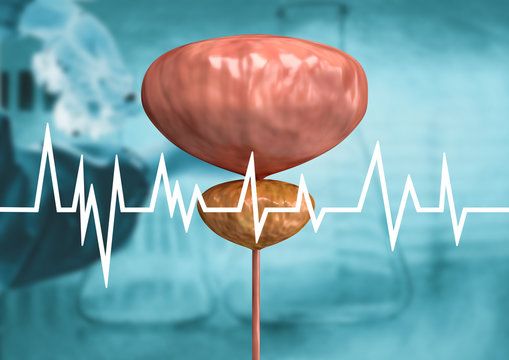 전립선 PSA 정상수치