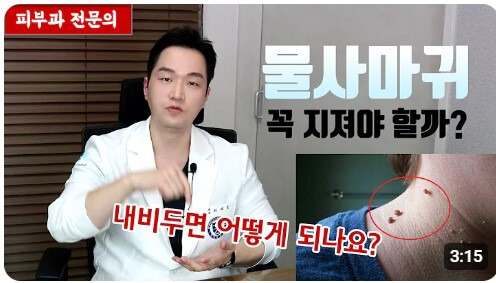 물사마귀 없애는 방법 - 피부과 전문의 유튜브 영상