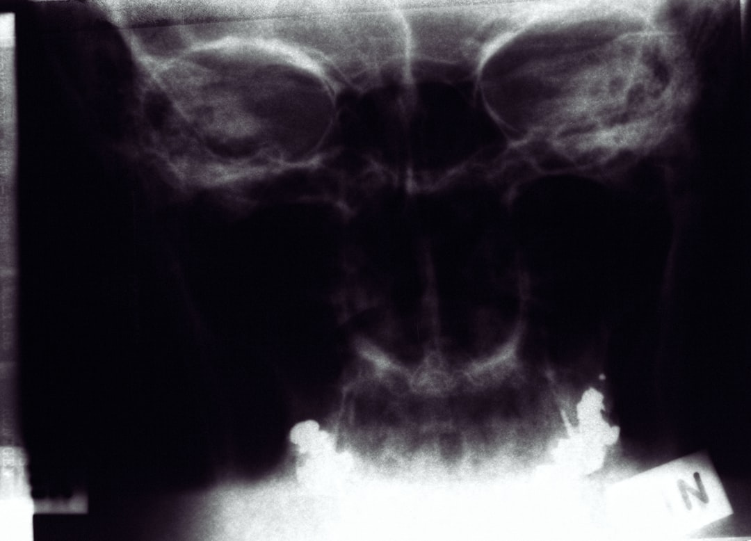 Colonoscopy