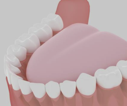 사랑니 발치후 식사 주의사항 가이드