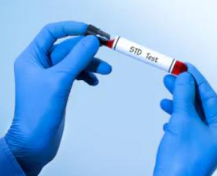 유레아플라즈마 파붐3