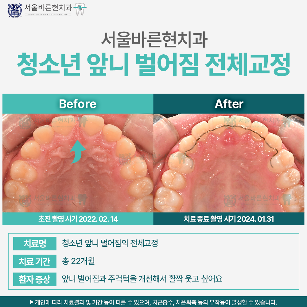 부산교정치과